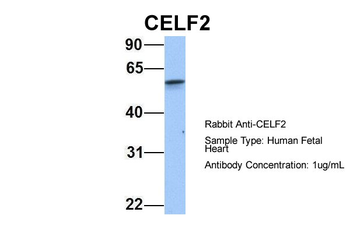 CELF2 Rabbit Polyclonal Antibody