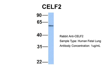 CELF2 Rabbit Polyclonal Antibody