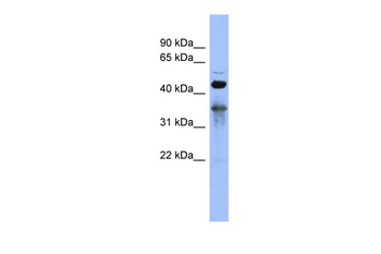 RBM9 Rabbit Polyclonal Antibody