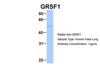 GRSF1 Rabbit Polyclonal Antibody
