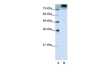 EIF3S9 Rabbit Polyclonal Antibody