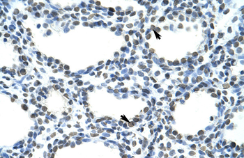 SFRS10 Rabbit Polyclonal Antibody