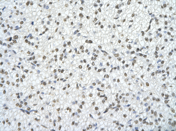 SFRS10 Rabbit Polyclonal Antibody