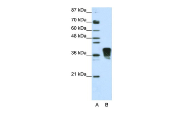 SFRS10 Rabbit Polyclonal Antibody