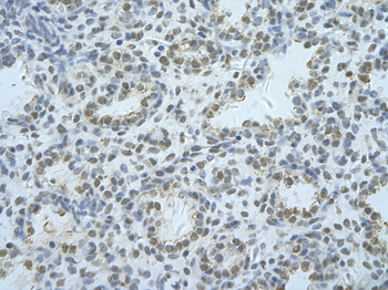 HNRPF Rabbit Polyclonal Antibody