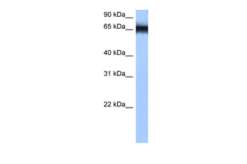 HNRPM Rabbit Polyclonal Antibody