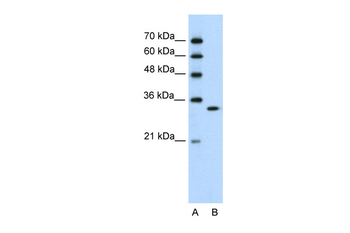 RNASEH2A Rabbit Polyclonal Antibody
