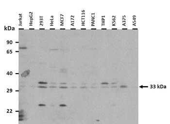 RNASEH2A Rabbit Polyclonal Antibody