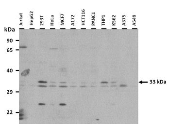 RNASEH2A Rabbit Polyclonal Antibody