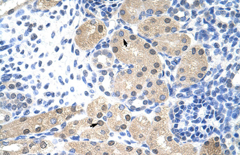 RNASEH2A Rabbit Polyclonal Antibody