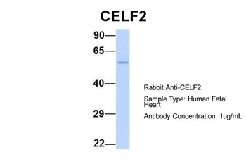 CUGBP2 Rabbit Polyclonal Antibody