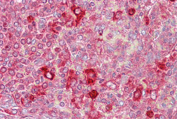 CUGBP2 Rabbit Polyclonal Antibody