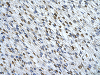 HNRPA0 Rabbit Polyclonal Antibody
