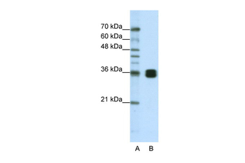 HNRPA0 Rabbit Polyclonal Antibody