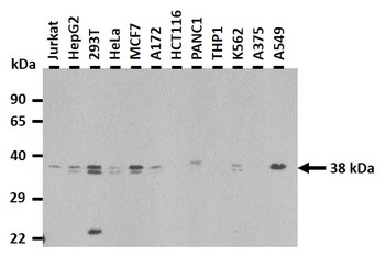 HNRPH3 Rabbit Polyclonal Antibody