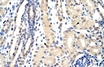 EXOSC3 Rabbit Polyclonal Antibody