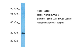 EXOSC5 Rabbit Polyclonal Antibody