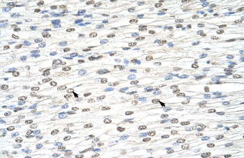 MGC42174 Rabbit Polyclonal Antibody