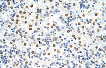 HNRPA3 Rabbit Polyclonal Antibody