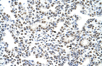 HNRPA3 Rabbit Polyclonal Antibody