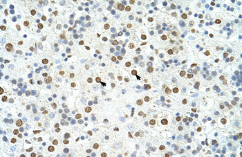 HNRPA3 Rabbit Polyclonal Antibody
