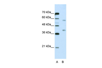 HNRPA3 Rabbit Polyclonal Antibody