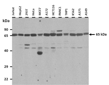 KRT2A Rabbit Polyclonal Antibody
