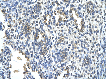 KRT2A Rabbit Polyclonal Antibody