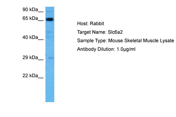 SLC6A2 Rabbit Polyclonal Antibody