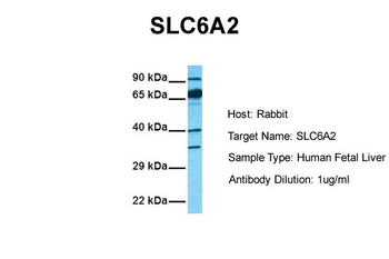 SLC6A2 Rabbit Polyclonal Antibody