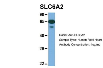 SLC6A2 Rabbit Polyclonal Antibody