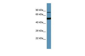 HGFAC Rabbit Polyclonal Antibody