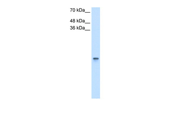 RBP1 Rabbit Polyclonal Antibody
