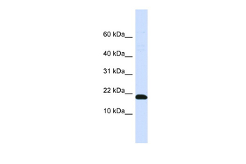 DNAJC25-GNG10 Rabbit Polyclonal Antibody