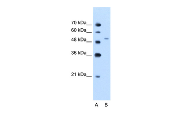 PBEF1 Rabbit Polyclonal Antibody