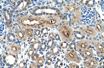 CLEC4M Rabbit Polyclonal Antibody