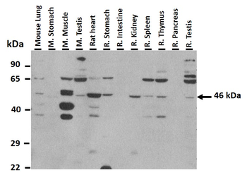 Atat1 Rabbit Polyclonal Antibody