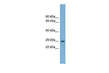 CLEC4M Rabbit Polyclonal Antibody
