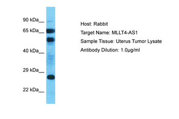 AFDN-DT Rabbit Polyclonal Antibody