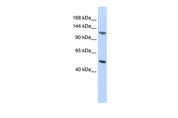 HERC5 Rabbit Polyclonal Antibody