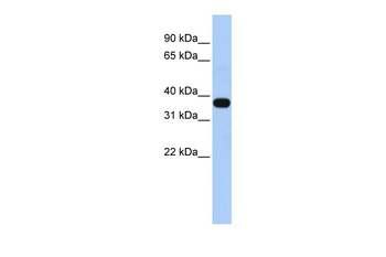 C1orf166 Rabbit Polyclonal Antibody