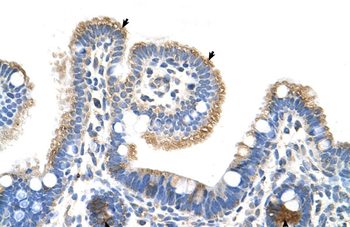 RNF39 Rabbit Polyclonal Antibody