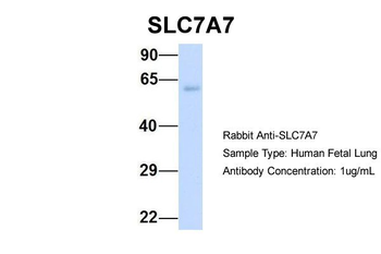 SLC7A7 Rabbit Polyclonal Antibody
