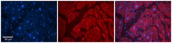 SLC6A5 Rabbit Polyclonal Antibody