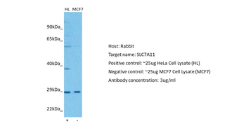 SLC7A11 Rabbit Polyclonal Antibody