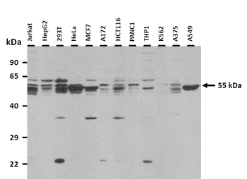 SLC2A6 Rabbit Polyclonal Antibody