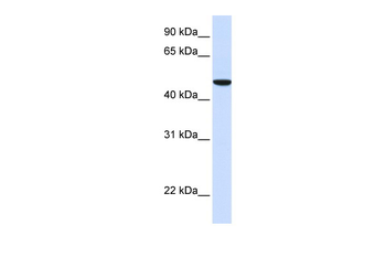 SLC2A6 Rabbit Polyclonal Antibody