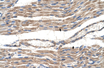 SLC2A6 Rabbit Polyclonal Antibody