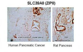 SLC39A8 Rabbit Polyclonal Antibody