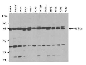 TYRP1 Rabbit Polyclonal Antibody